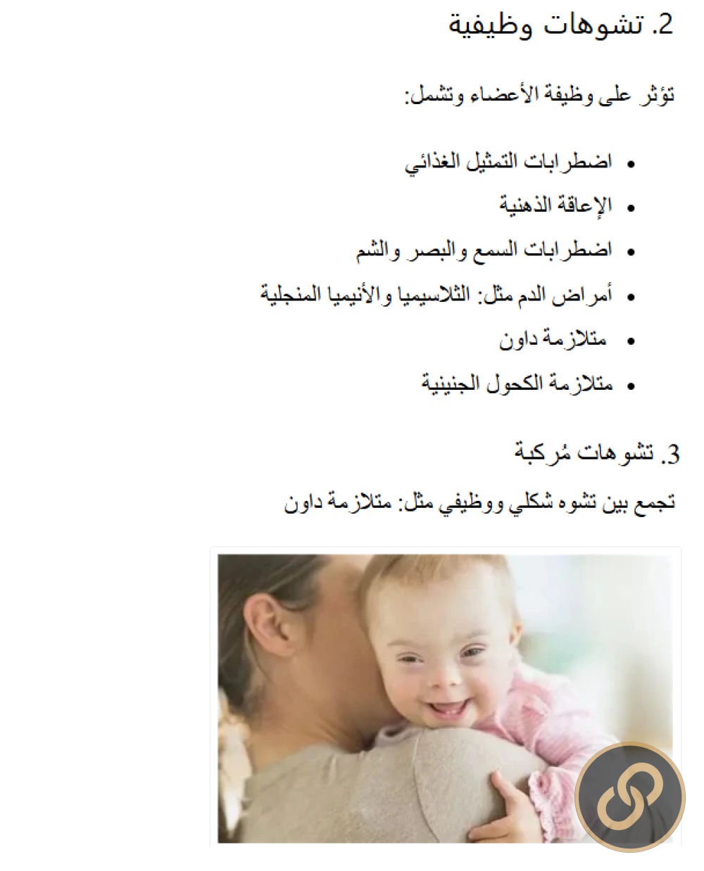 مقال : تشوهات الأجنة